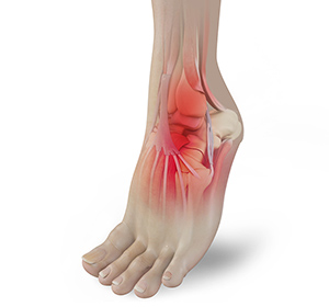 Foot & Ankle