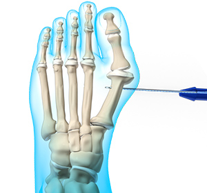 Foot & Ankle