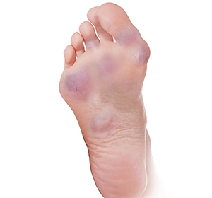 Foot & Ankle