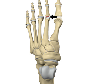 Foot & Ankle