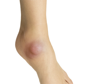 Foot & Ankle