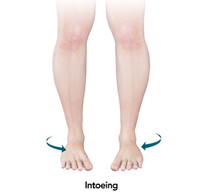 Foot & Ankle