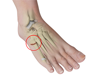 Foot & Ankle