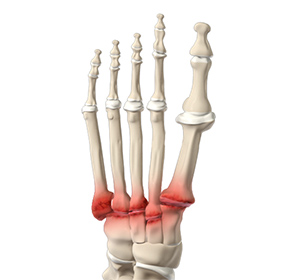 Foot & Ankle