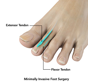 Foot & Ankle
