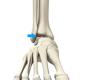 Foot & Ankle