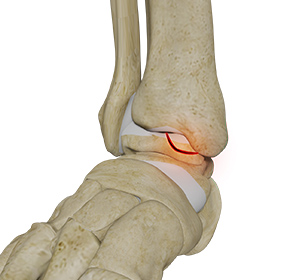 Foot & Ankle