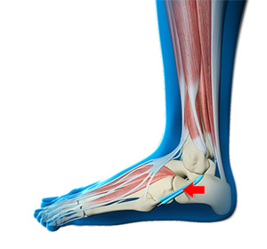 Foot & Ankle