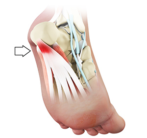 Foot & Ankle