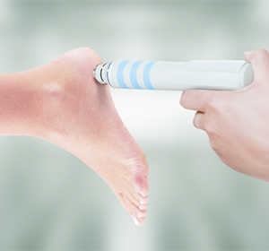 Foot & Ankle