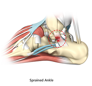 Foot & Ankle