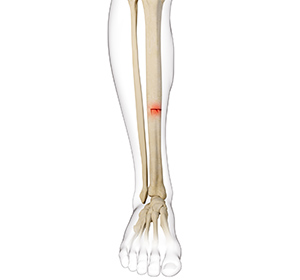 Foot & Ankle