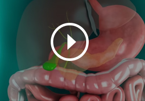 Patient Education Video