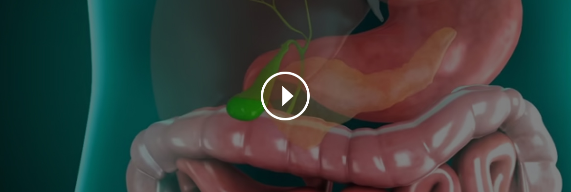 Patient Education Video