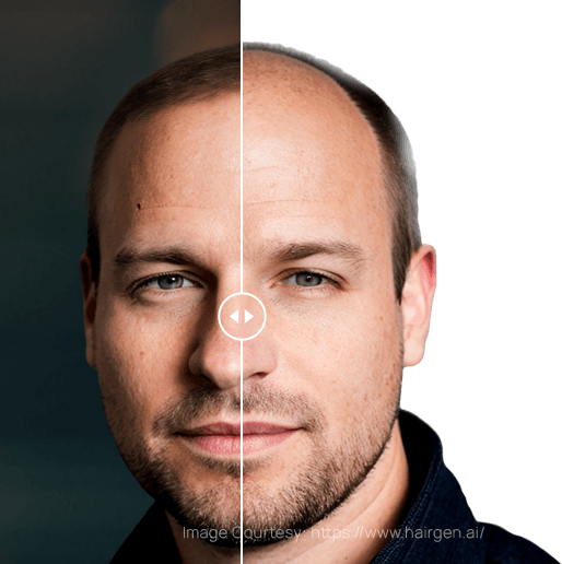 Before & After AI  pic