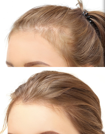 blog2  pic