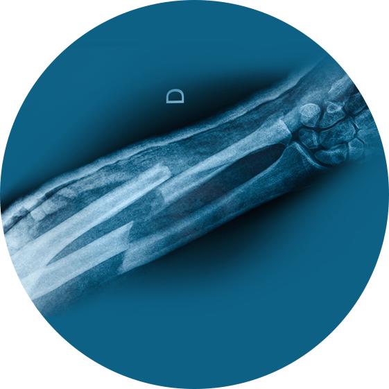 Andrew Tyler, MD,PhD Orthopedic Surgeon Specialist in Trauma Surgery
