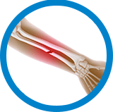 Pediatric Fractures home
