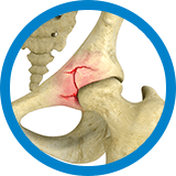 Pelvic Fractures home