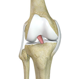 Faster ACL Recovery: Inside the fertilized ACL Technique with Dr. Chad Lavender.