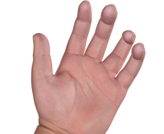 Precision Hands: Dr. Wayne Weil