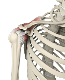 Revolutionizing Shoulder Surgery with Dr. Patrick Denard