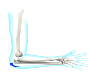 Elbow Dislocation pic