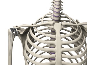 Outpatient Shoulder Replacement-topic