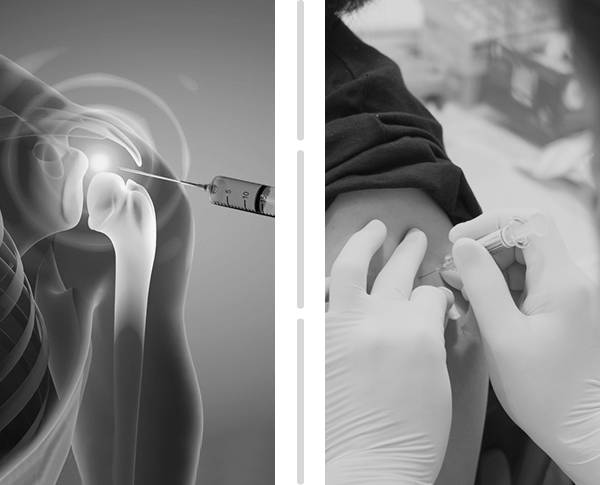 Picture of Platelet Rich Plasma Injections