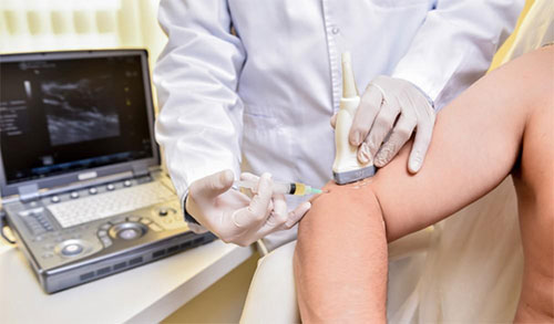 PRP & Stem Cell Therapy for Hand, Wrist & Elbow Pain