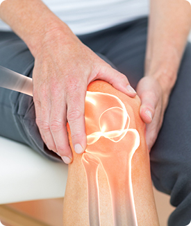 Partial Knee Replacement Icon