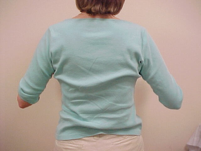 Shoulder Exercise 2a