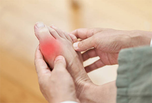 Picture of What Causes Gout