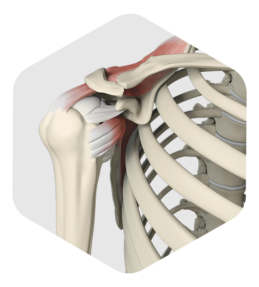 Rotator Cuff Repair Icon