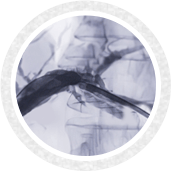 Cholangiopancreatography - service