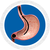 Upper GI Endoscopy - service