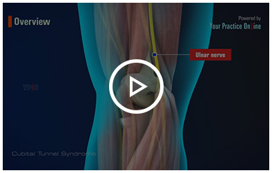 Cubital Tunnel Syndrome