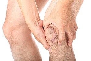 Knee Infection1