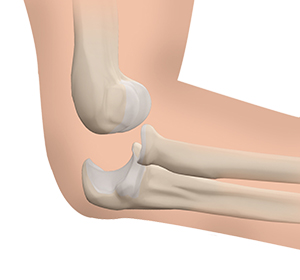 Elbow Instability Images