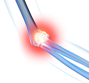 Elbow Pain Images