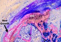 Rotator Cuff Healing logo