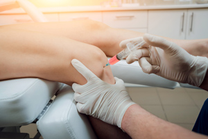 Regenerative Medicine for Sports Injuries