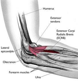 Ulnar Nerve Subluxation 2