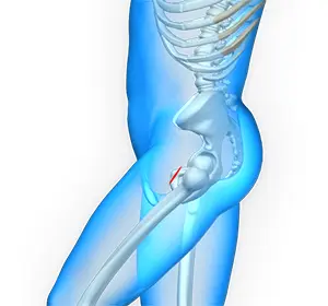Minimally invasive Hip Surgery