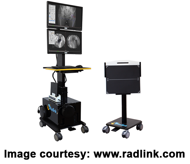 Radlink Assisted Hip Replacement
