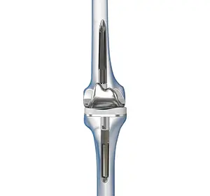 Revision Knee Replacement