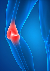 Partial Medial Knee Replacement