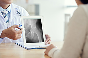 Hip Second Opinion pic