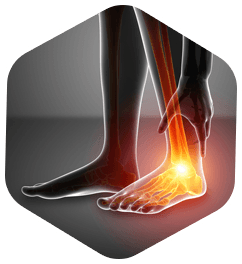 Foot & Ankle