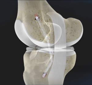 pcl reconstruction img